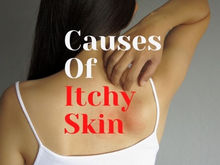 What Are The Causes of Itchy Skin
